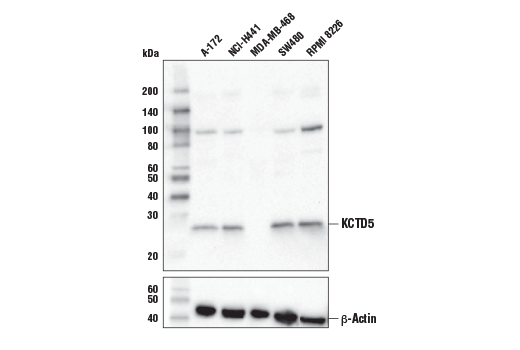 Western Blotting Image 1: KCTD5 Antibody
