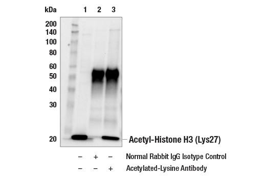 Immunoprecipitation Image 1: Acetylated-Lysine Antibody