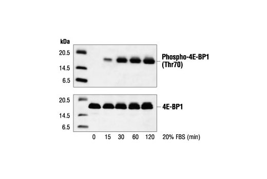  Image 8: 4E-BP Antibody Sampler Kit
