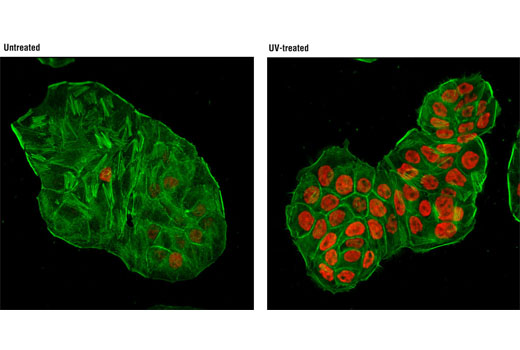 Immunofluorescence Image 1: Phospho-p53 (Ser15) (16G8) Mouse mAb (Alexa Fluor® 555 Conjugate)
