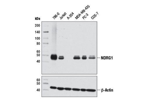  Image 10: NDRG Family Antibody Sampler Kit