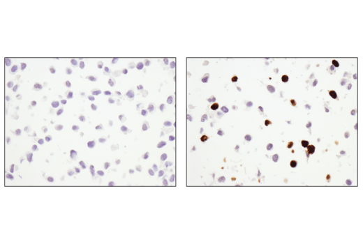 Immunohistochemistry Image 1: Cleaved PARP (Asp214) (D6X6X) Rabbit mAb
