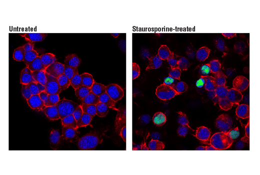 Immunofluorescence Image 1: Cleaved PARP (Asp214) (D6X6X) Rabbit mAb