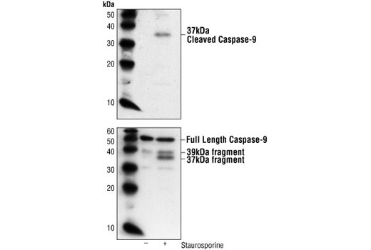  Image 12: Apoptosis Antibody Sampler Kit (Mouse Preferred)