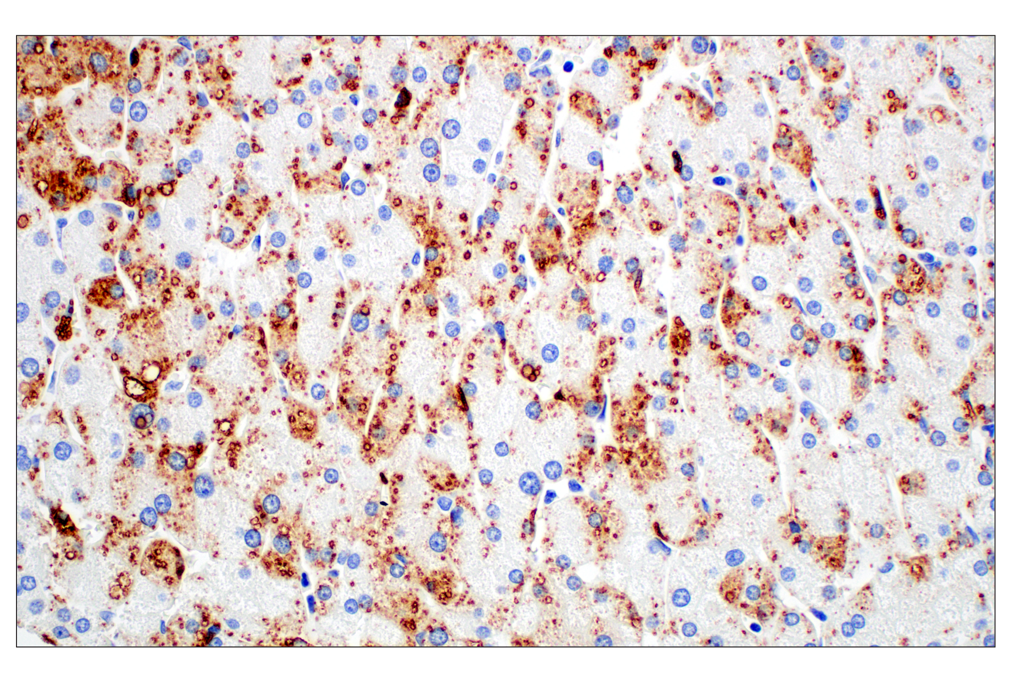 Immunohistochemistry Image 14: Perilipin-2 (E6G6M) Rabbit mAb