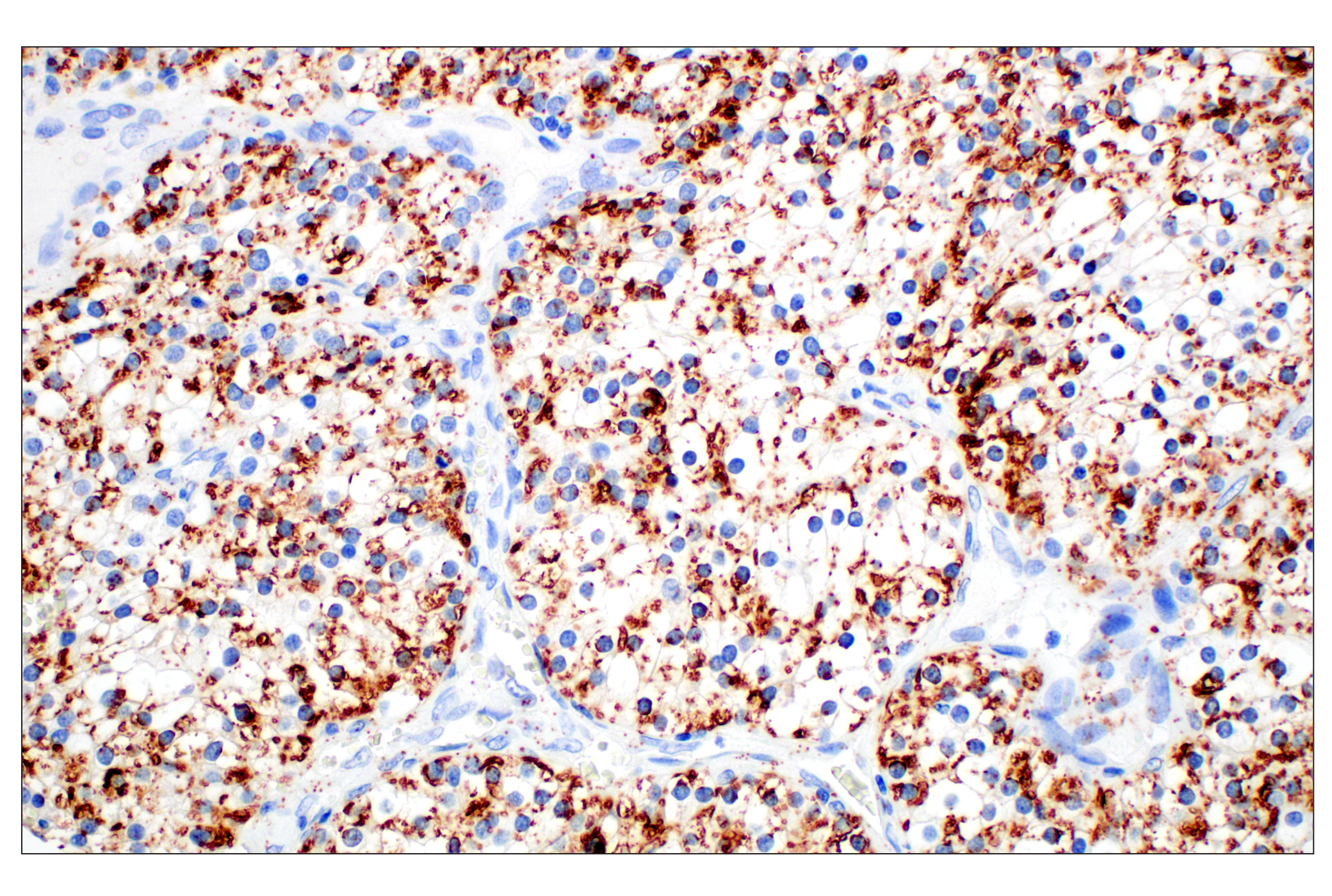 Immunohistochemistry Image 4: Perilipin-2 (E6G6M) Rabbit mAb