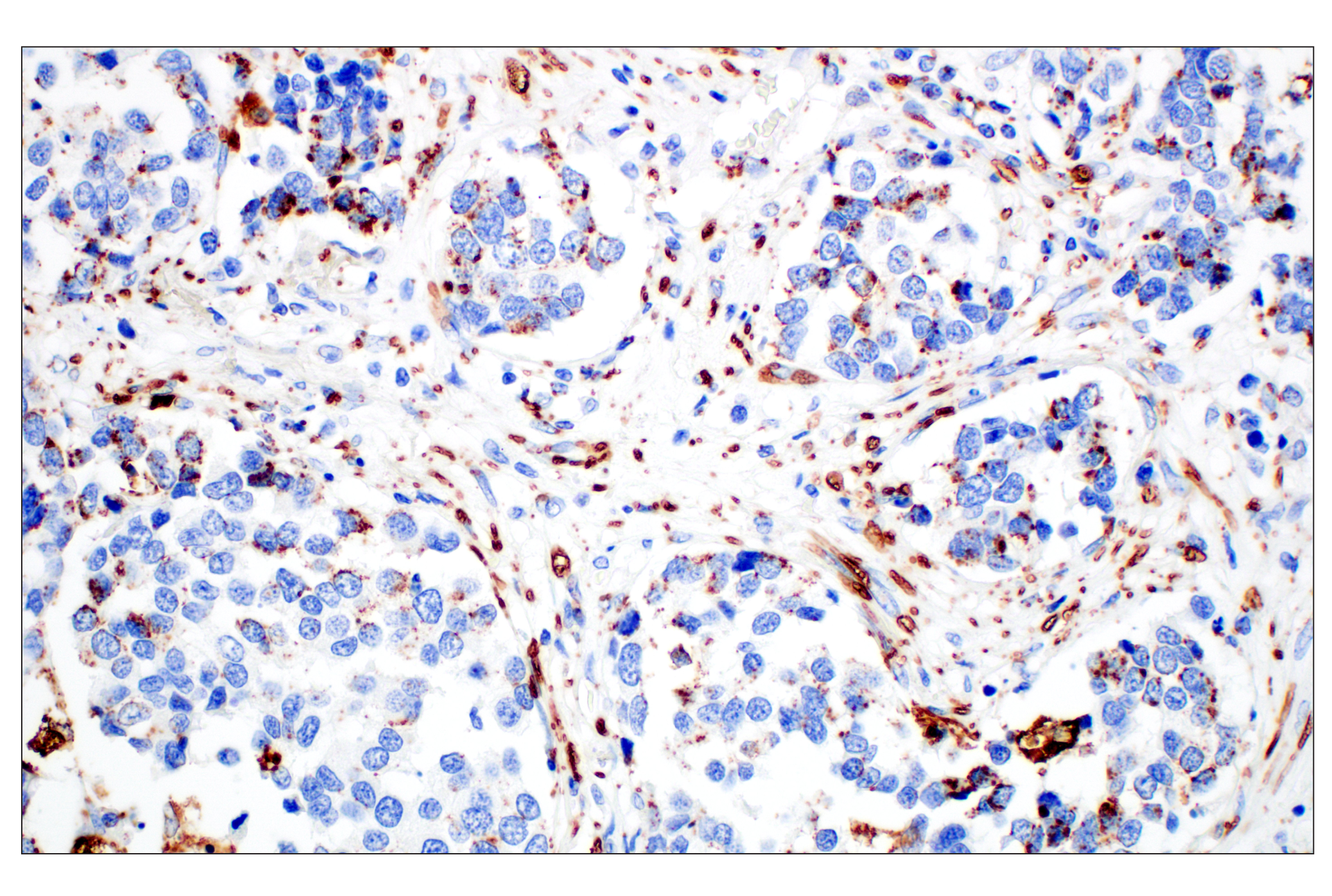 Immunohistochemistry Image 3: Perilipin-2 (E6G6M) Rabbit mAb