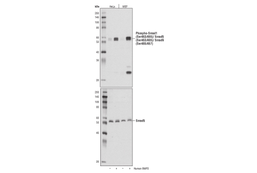 Western Blotting Image 1: Phospho-Smad1 (Ser463/465)/ Smad5 (Ser463/465)/ Smad9 (Ser465/467) Antibody