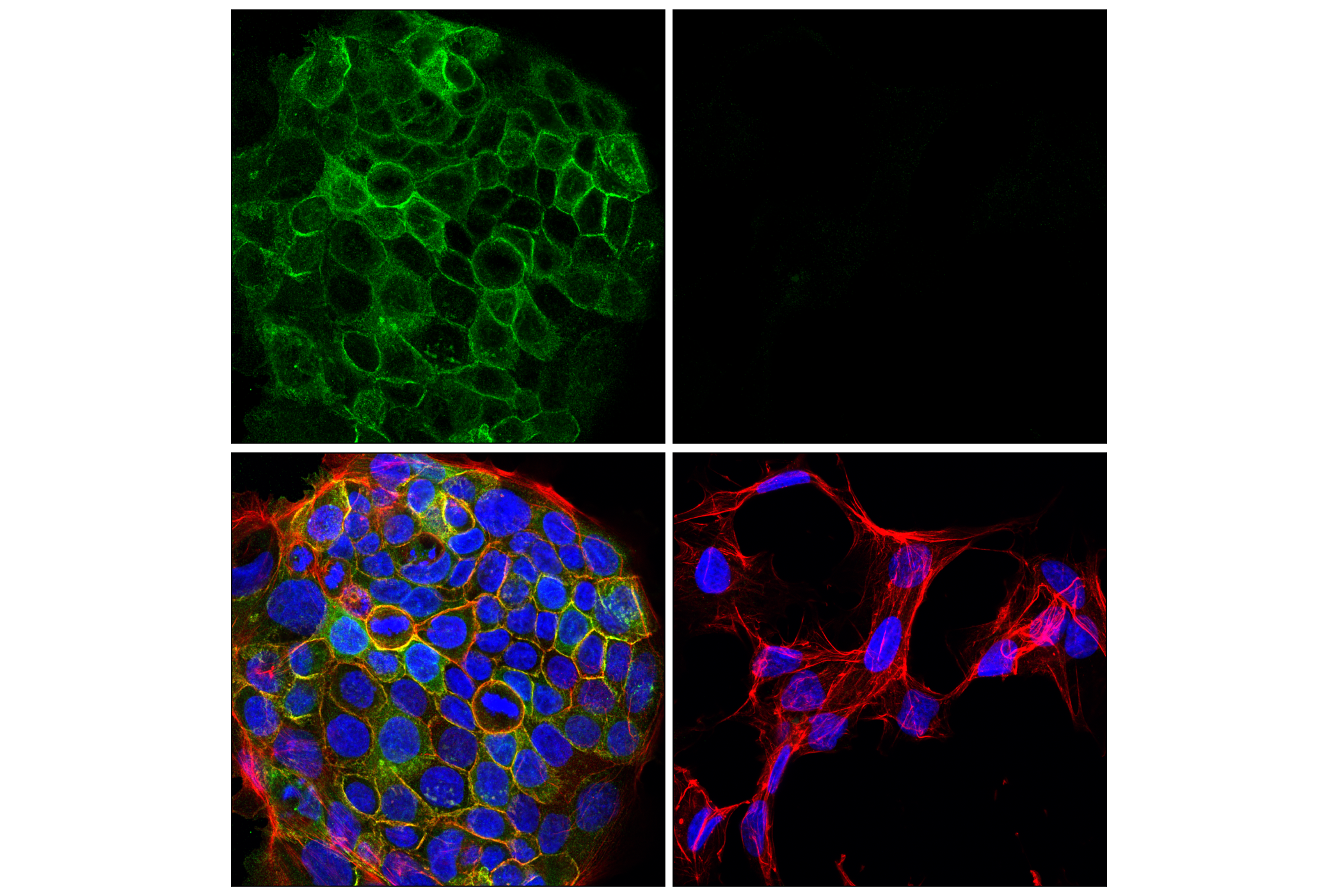 Immunofluorescence Image 1: Integrin β6 (E4M9P) XP® Rabbit mAb