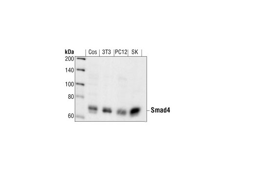 Western Blotting Image 1: Smad4 Antibody