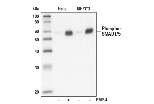 Western Blotting Image 1: Phospho-SMAD1/5 (Ser463/465) (41D10) Rabbit mAb