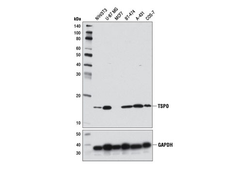 Western Blotting Image 1: TSPO Antibody