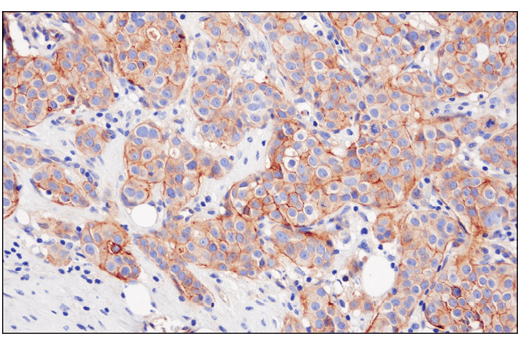 Immunohistochemistry Image 4: Nectin-2/CD112 (D8D3F) XP® Rabbit mAb (BSA and Azide Free)