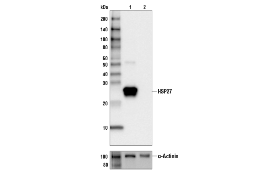  Image 1: PhosphoPlus® HSP27 (Ser82) Antibody Duet