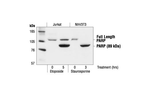 Western Blotting Image 1: PARP Antibody