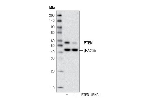 Western Blotting Image 2: PTEN Antibody