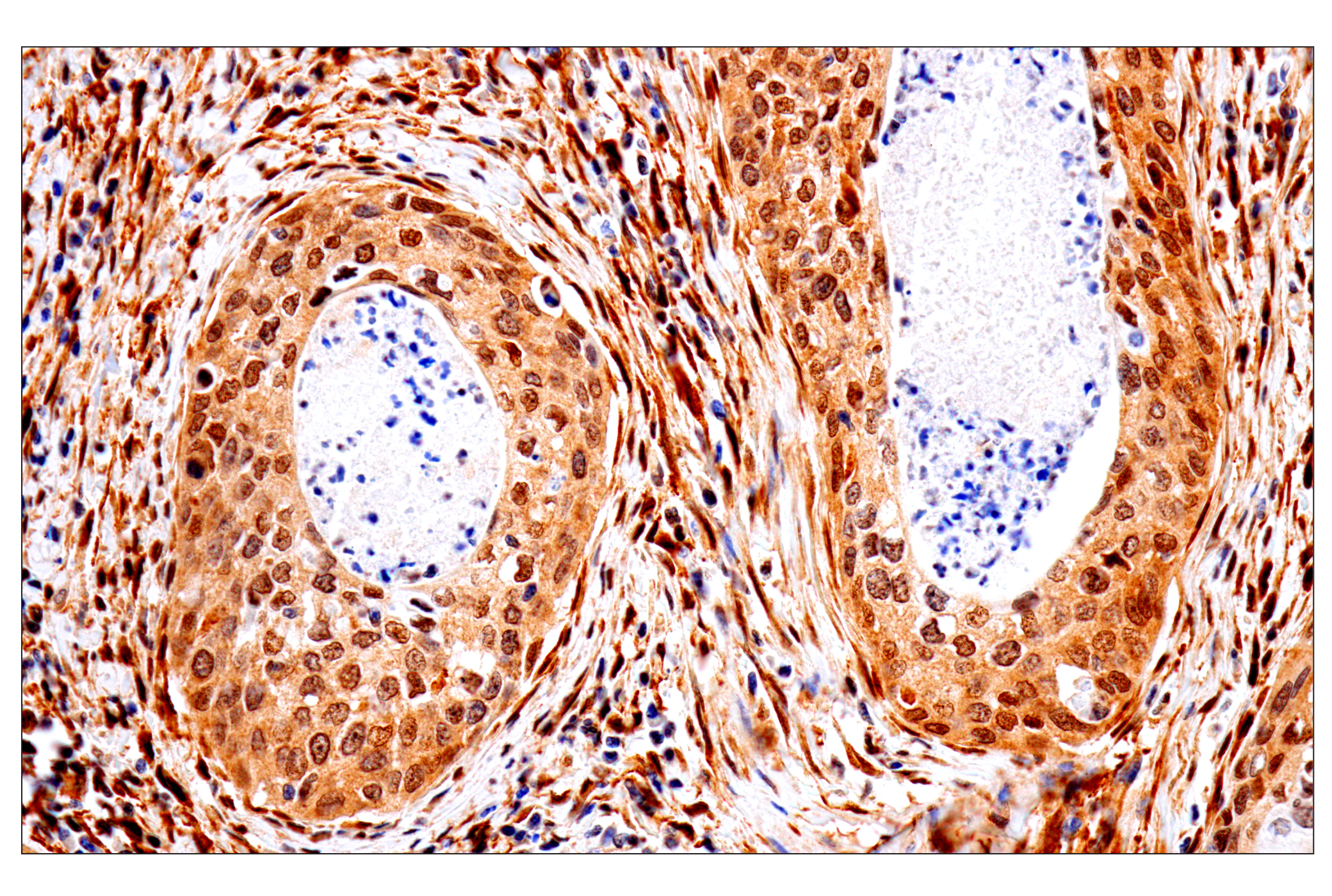 Immunohistochemistry Image 3: PTEN (138G6) Rabbit mAb