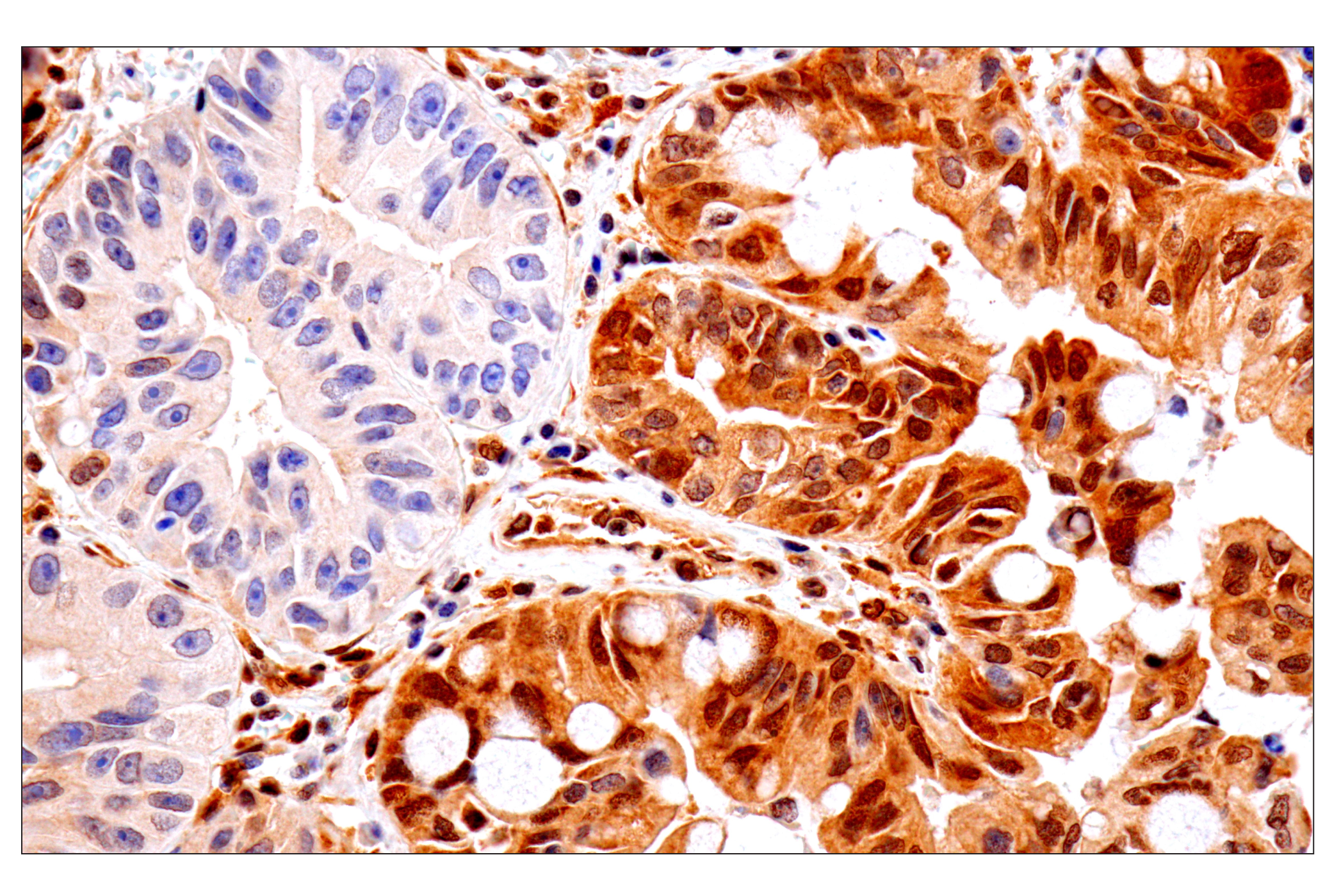  Image 22: Oncogene and Tumor Suppressor Antibody Sampler Kit