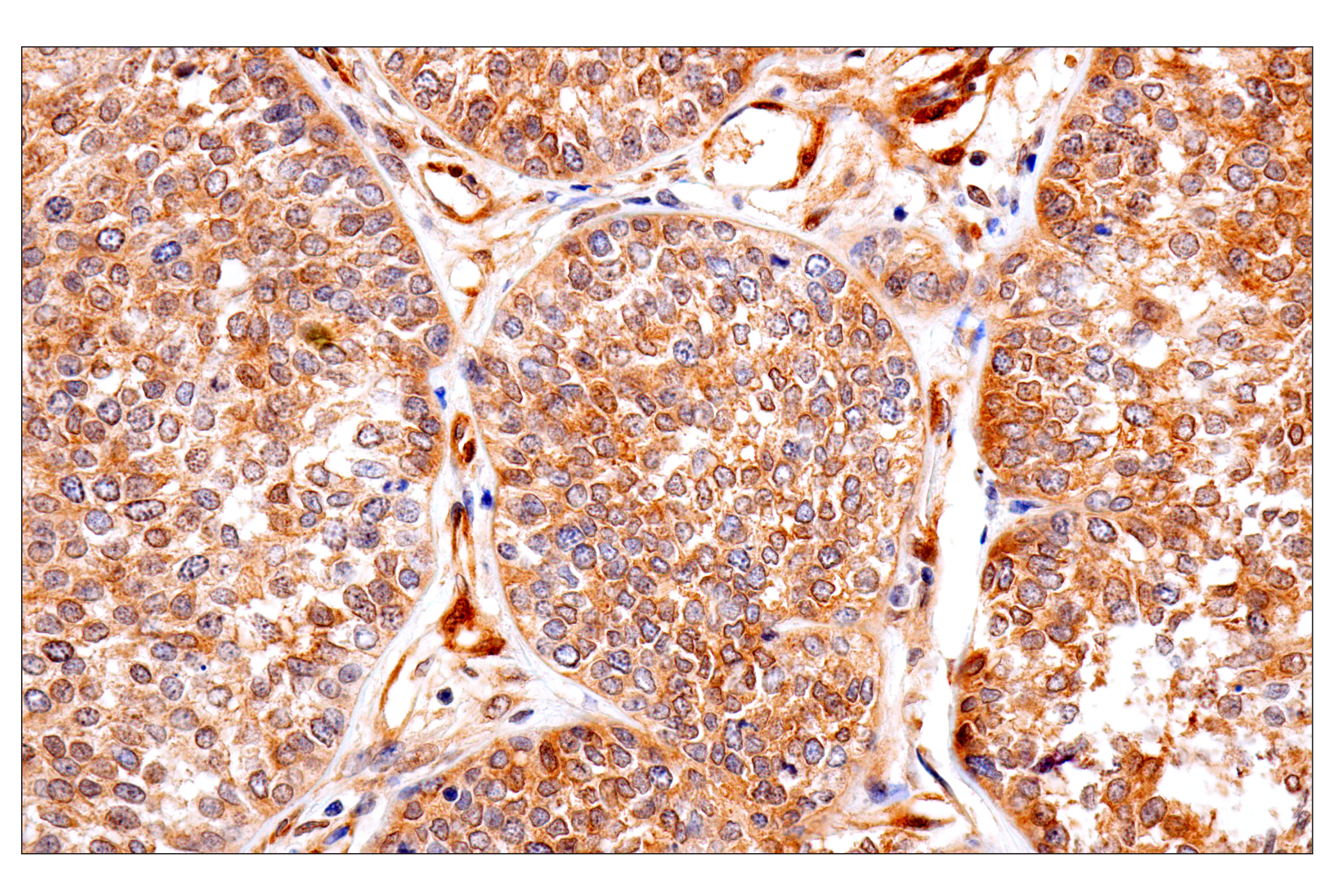 Immunohistochemistry Image 1: PTEN (138G6) Rabbit mAb