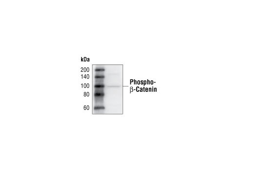 Western Blotting Image 2: Phospho-β-Catenin (Ser33/37/Thr41) Antibody