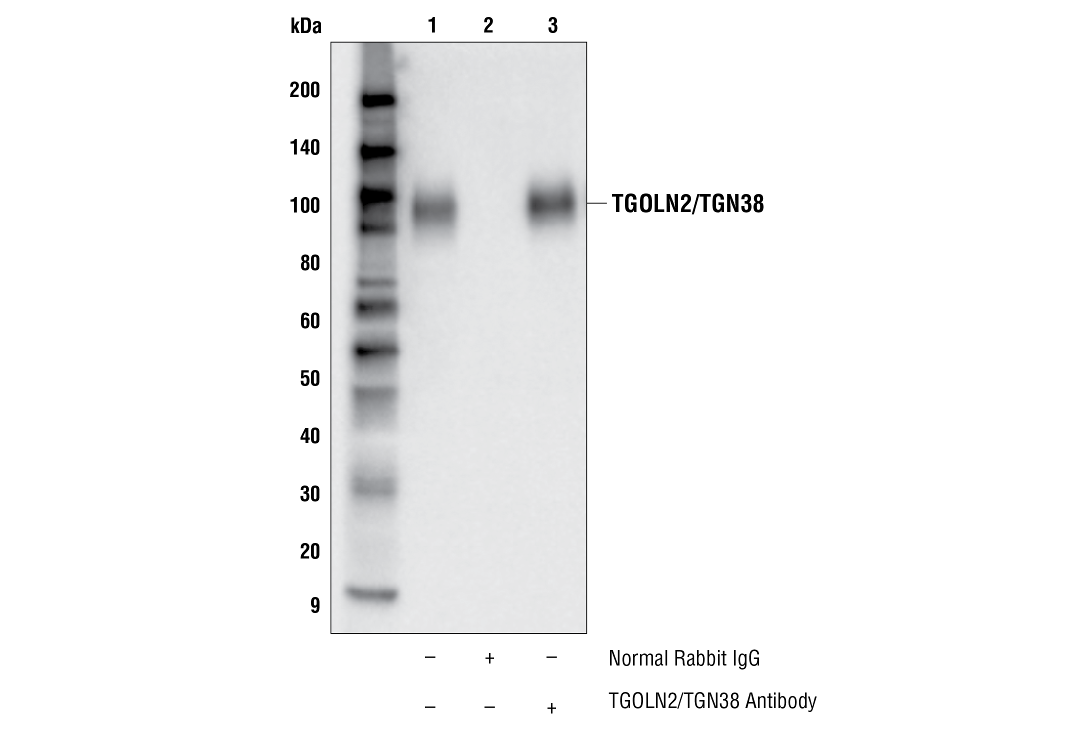 Immunoprecipitation Image 1: TGOLN2/TGN38 Antibody