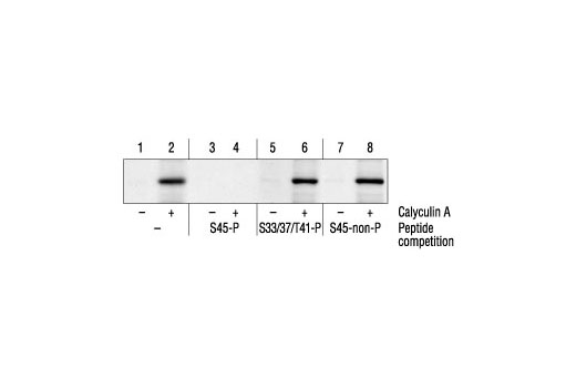Western Blotting Image 2: Phospho-β-Catenin (Ser45) Antibody