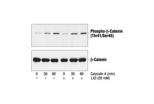 Western Blotting Image 1: Phospho-β-Catenin (Thr41/Ser45) Antibody