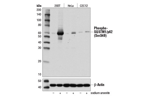 Western Blotting Image 1: Phospho-SQSTM1/p62 (Ser349) Antibody