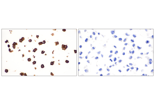 Immunohistochemistry Image 4: IL-2Rα/CD25 (E9W2J) XP® Rabbit mAb (BSA and Azide Free)
