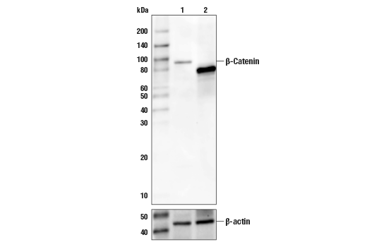Western Blotting Image 1: β-Catenin Antibody (Carboxy-terminal Antigen)