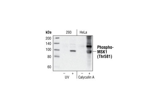Western Blotting Image 3: Phospho-MSK1 (Thr581) Antibody