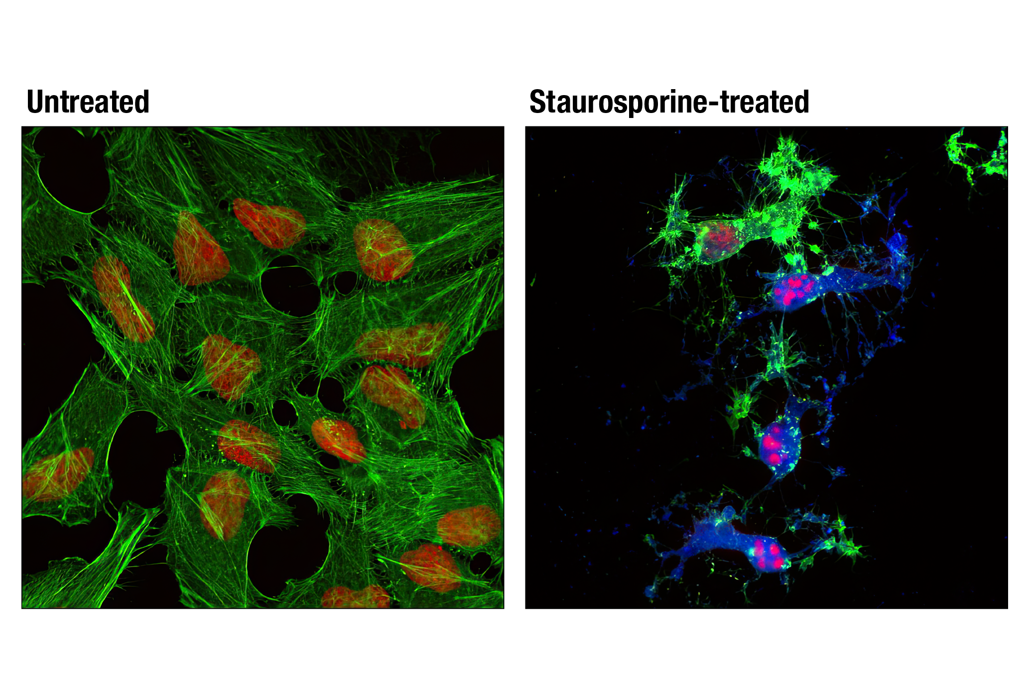 Immunofluorescence Image 1: Cleaved Caspase-3 (Asp175) (D3E9) Rabbit mAb (Alexa Fluor® 647 Conjugate)