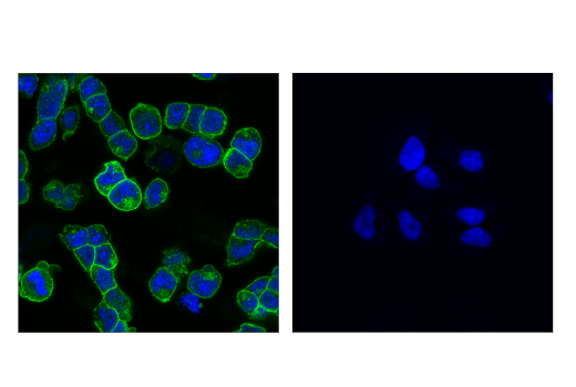Immunofluorescence Image 1: DLL4 (D7N3H) Rabbit mAb