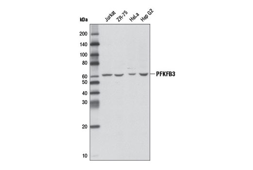 Western Blotting Image 1: PFKFB3 Antibody