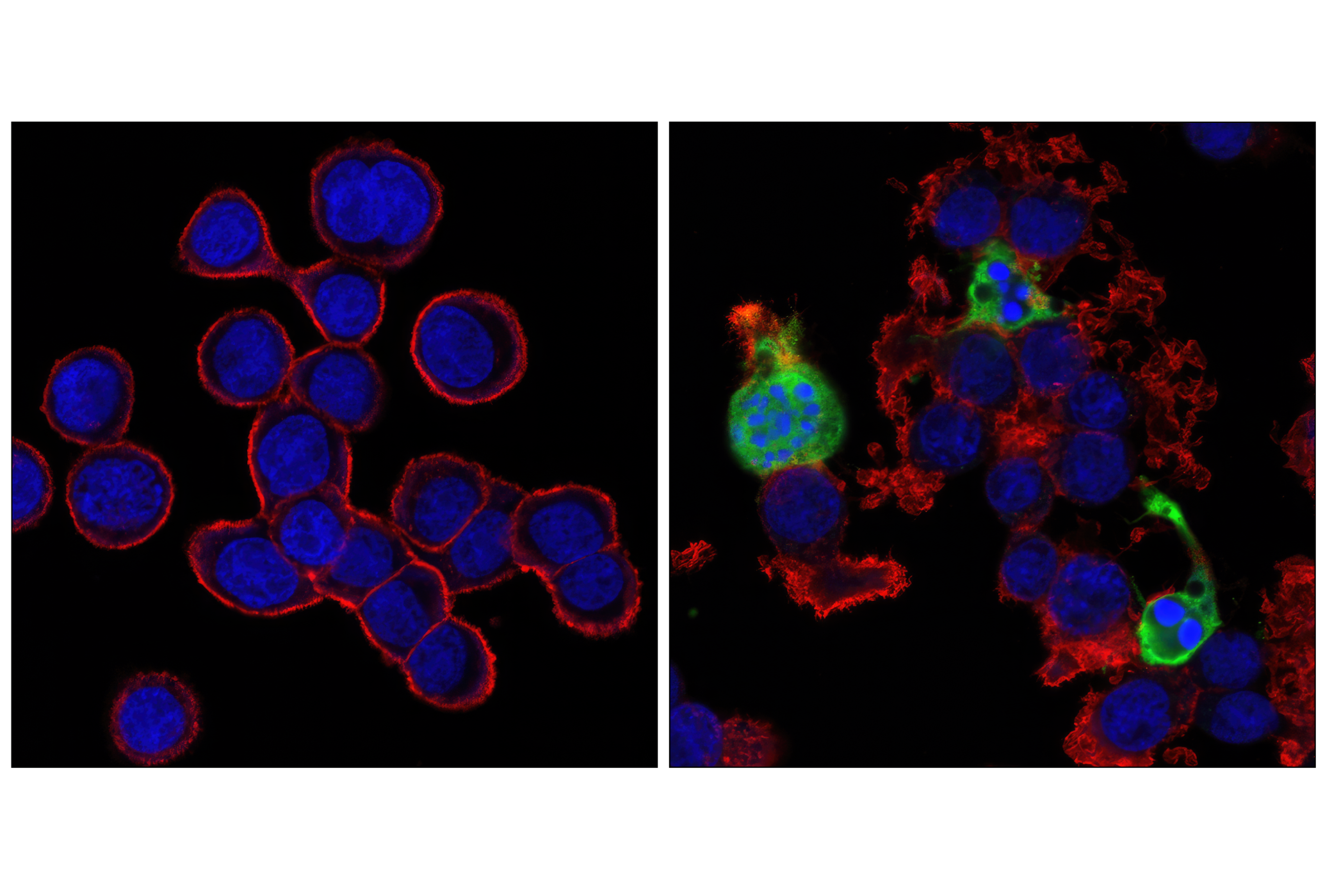 Immunofluorescence Image 1: Cleaved Caspase-3 (Asp175) Antibody