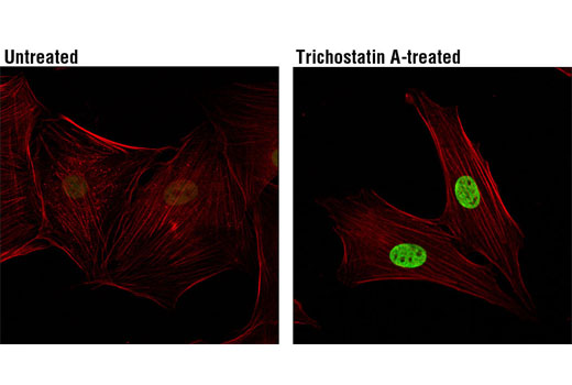 Immunofluorescence Image 1: Acetyl-Histone H3 (Lys9/Lys14) Antibody