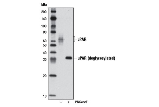  Image 1: uPAR Antibody
