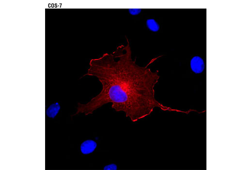Immunofluorescence Image 1: DYKDDDDK Tag Antibody (Binds to same epitope as Sigma's Anti-FLAG® M2 Antibody) (Alexa Fluor® 594 Conjugate)