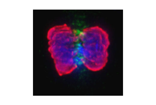 Immunofluorescence Image 1: Phospho-Histone H3 (Ser10) Antibody