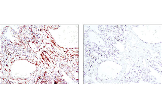 Immunohistochemistry Image 3: Phospho-HSP27 (Ser82) (D1H2F6) XP® Rabbit mAb (BSA and Azide Free)