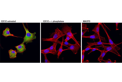 Immunofluorescence Image 1: Phospho-HSP27 (Ser82) (D1H2F6) XP® Rabbit mAb (BSA and Azide Free)