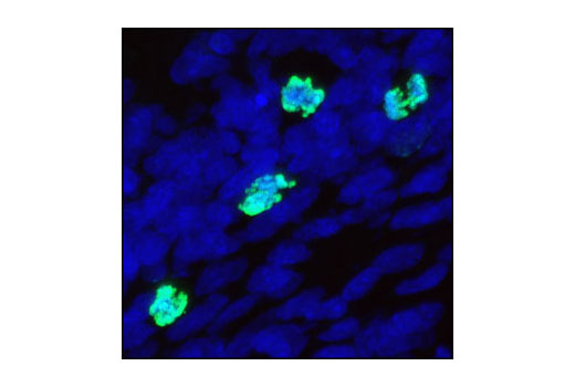  Image 12: Aurora A/B Substrate Antibody Sampler Kit