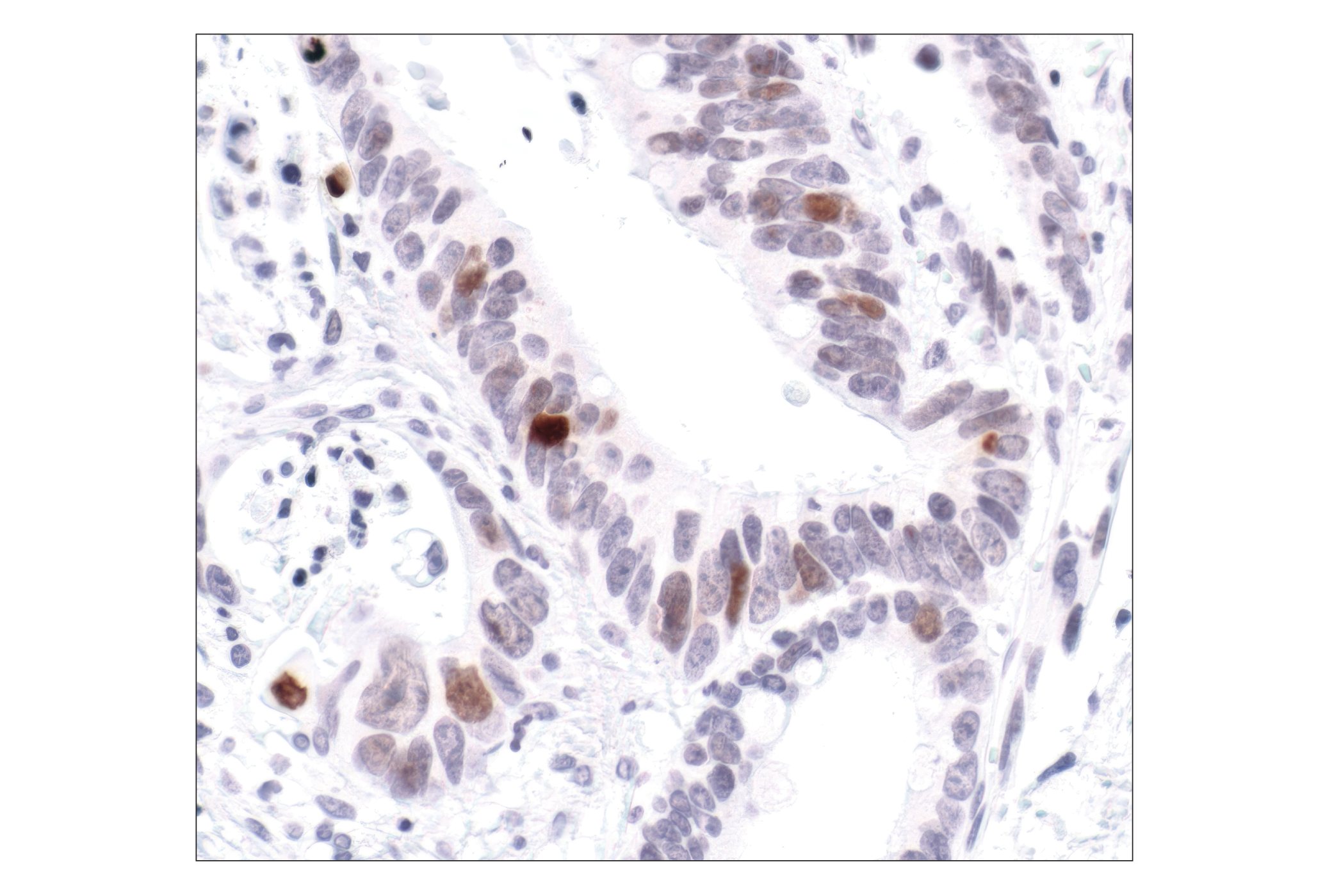 Immunohistochemistry Image 4: Phospho-Histone H2A.X (Ser139) (20E3) Rabbit mAb