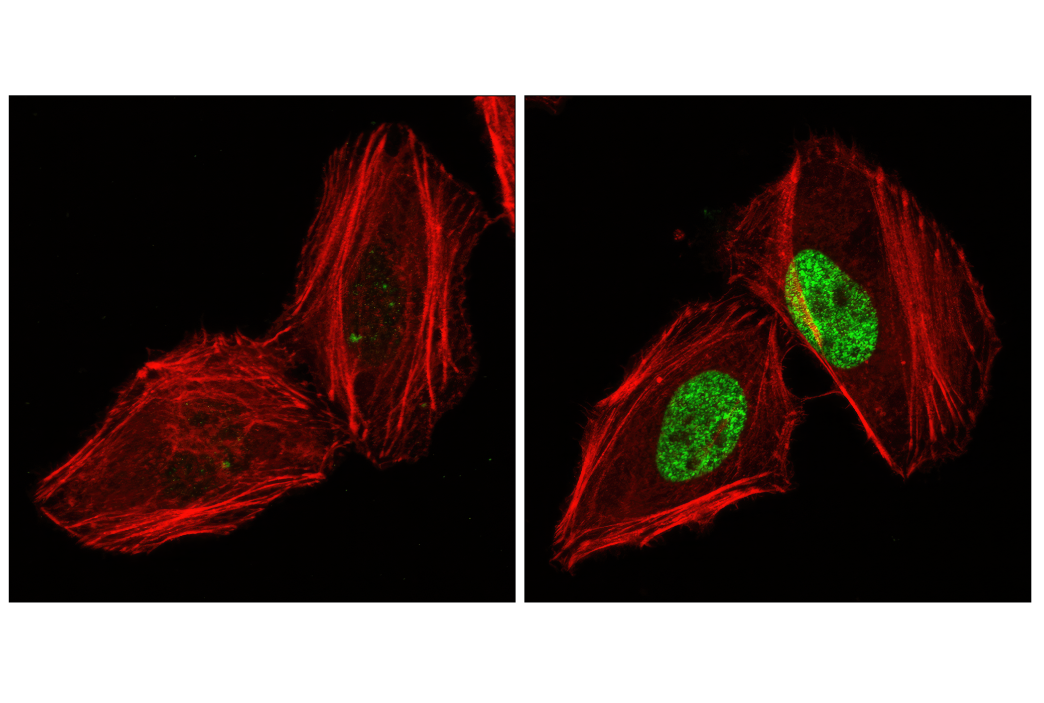 Immunofluorescence Image 1: Phospho-Histone H2A.X (Ser139) (20E3) Rabbit mAb