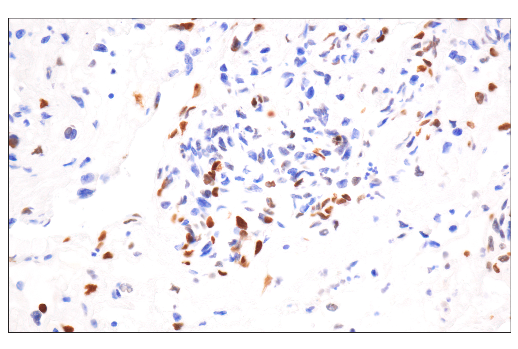 Immunohistochemistry Image 1: Phospho-Histone H2A.X (Ser139) (20E3) Rabbit mAb
