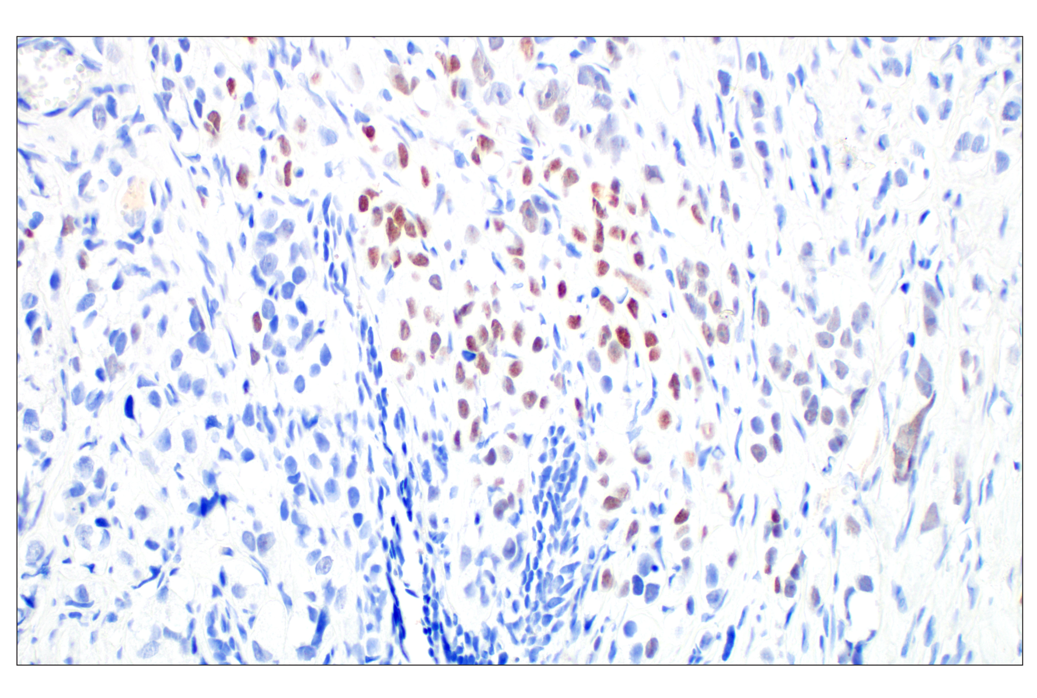  Image 6: PhosphoPlus® Histone H2A.X (Ser139) Antibody Duet