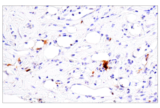Immunohistochemistry Image 2: Citrullinated Histone H3 (Arg17) (E4O3F) Rabbit mAb