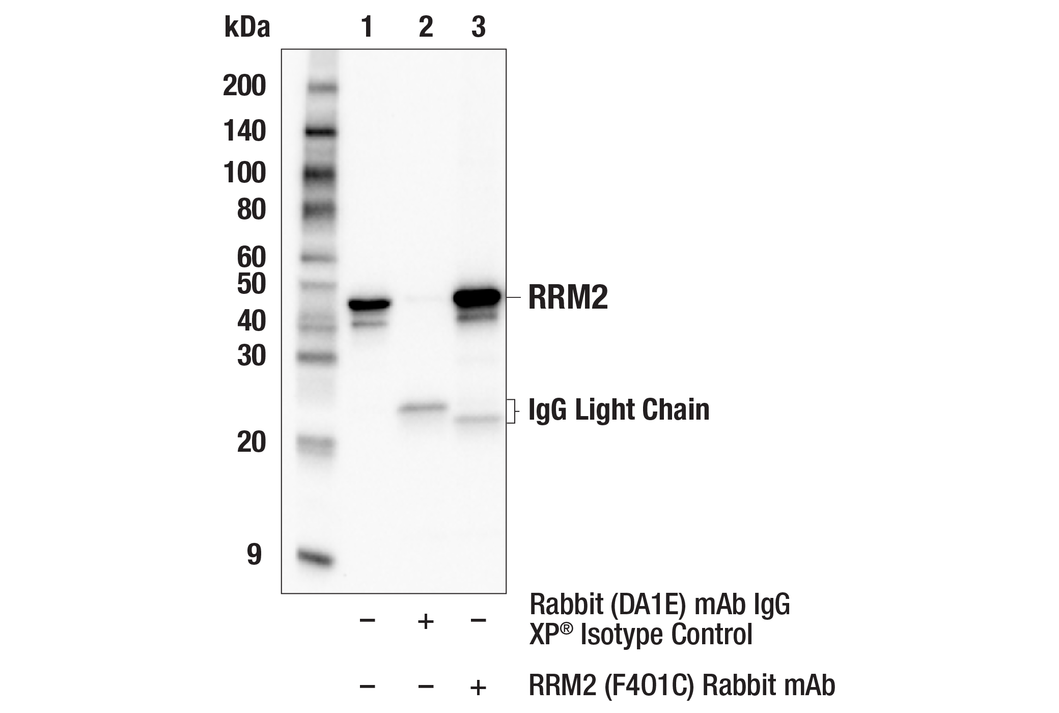 Immunoprecipitation Image 1: RRM2 (F4O1C) Rabbit mAb