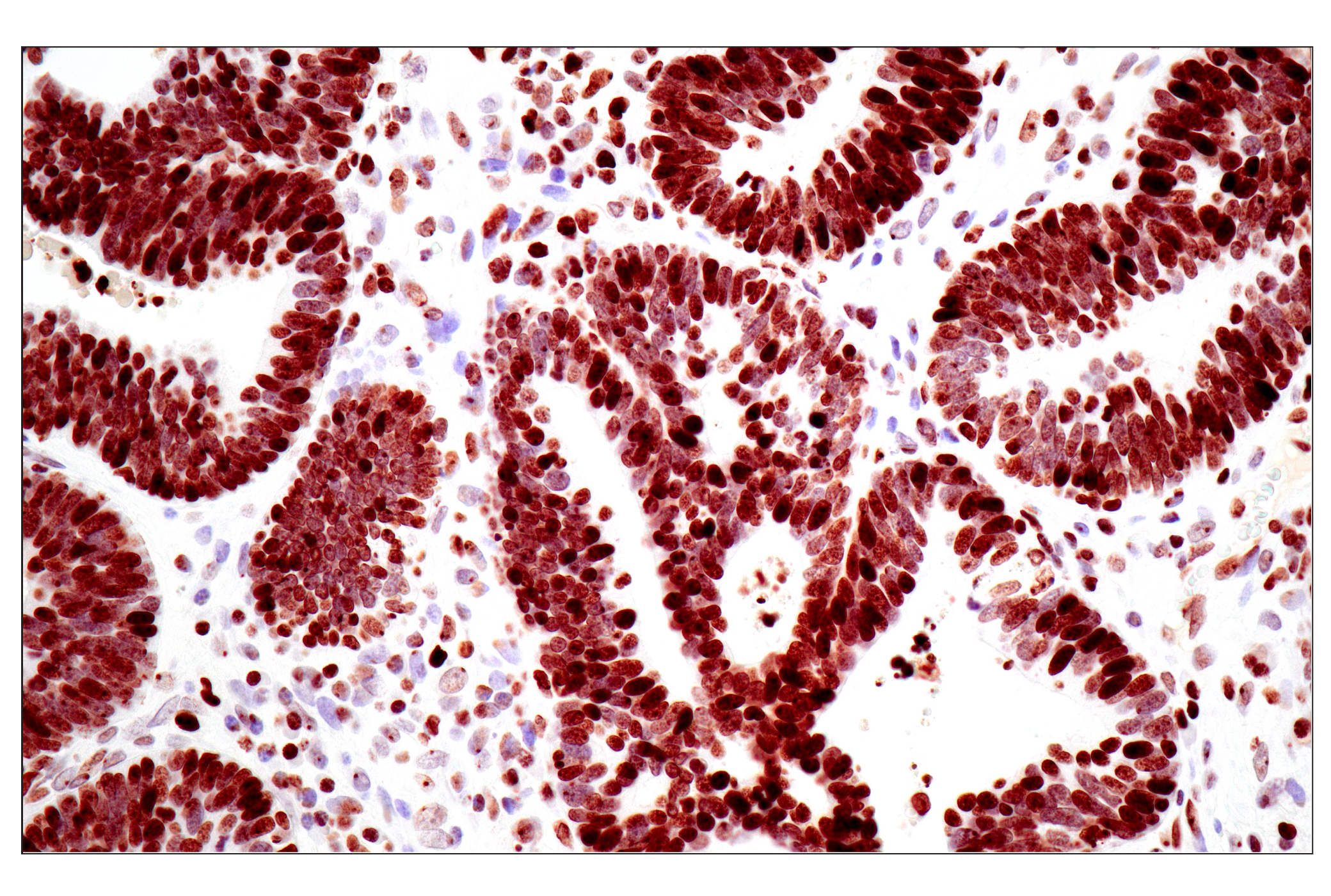  Image 15: Polycomb Group Antibody Sampler Kit