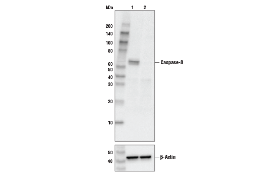  Image 19: Apoptosis Antibody Sampler Kit II